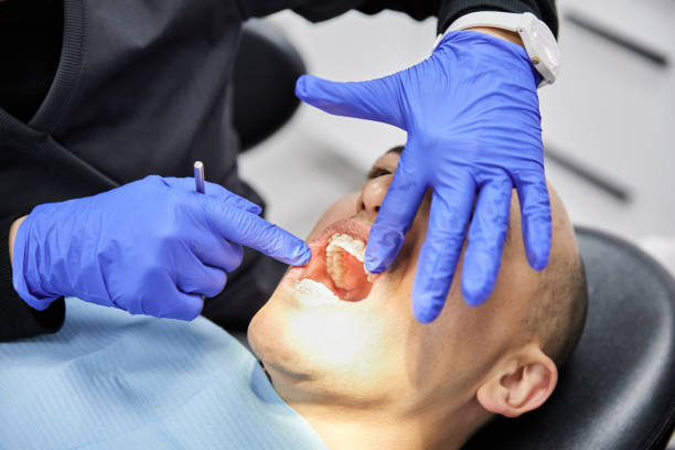 Best Broken or Cracked Tooth Emergency Dentist in Coral Gables, FL